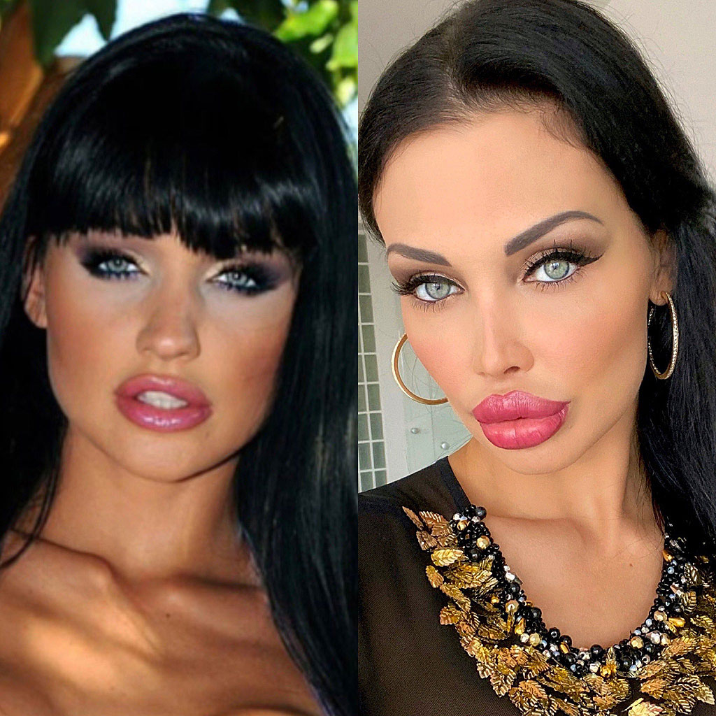 Aletta Ocean differenze nel viso tra giovane e ora a 35 anni nel 2023