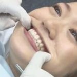 semen-gulping-at-the-dentists-office